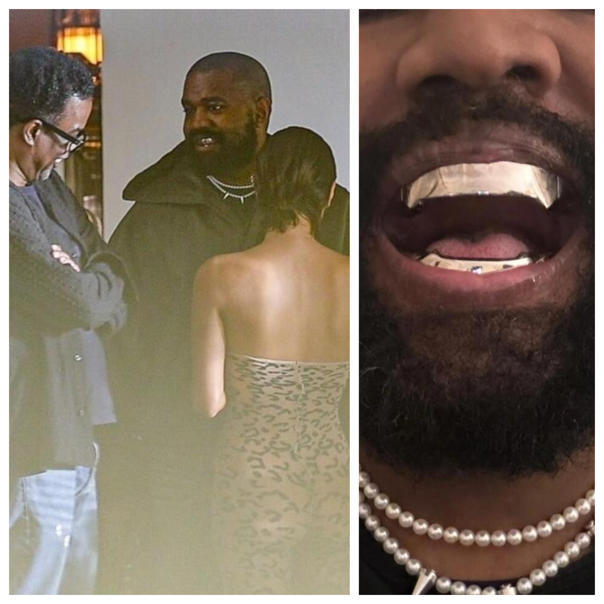 Kanye West flashed his new $850,000 titanium dentures 