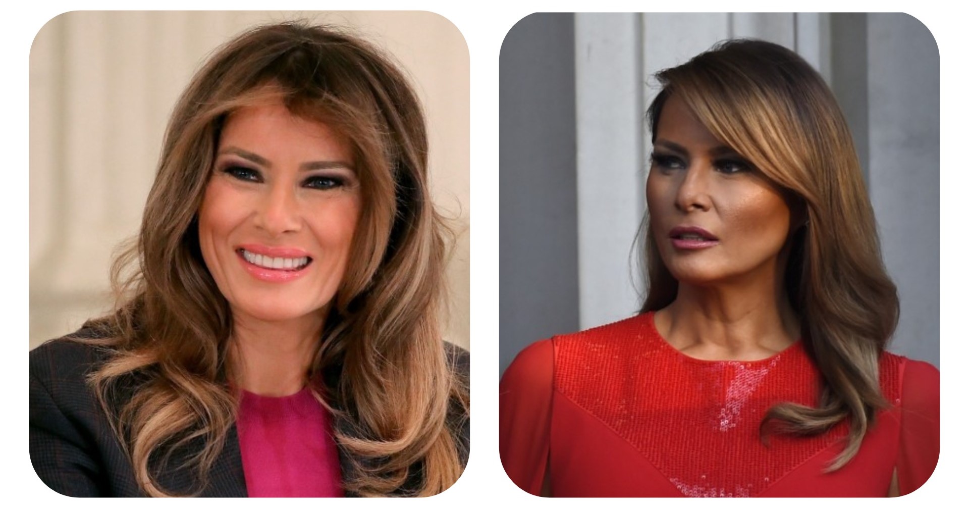 Melania Trump allegedly had a plastic surgery makeover