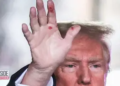 Donald Trump's hands