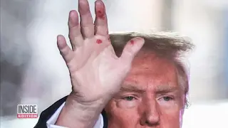 Donald Trump's hands