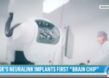 Here’s What Happened to Monkeys That Got the Neuralink Implant