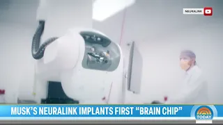 Here’s What Happened to Monkeys That Got the Neuralink Implant